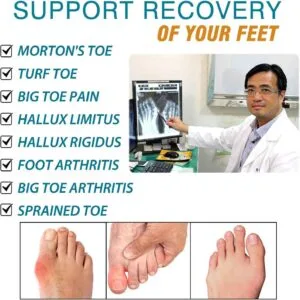 Morton's Extension Orthotic, palmilha de fibra de carbono, palmilha rígida de apoio para os pés para Morton's Toe, Turf Toe (8)